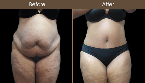 20202705155409_B25-Front